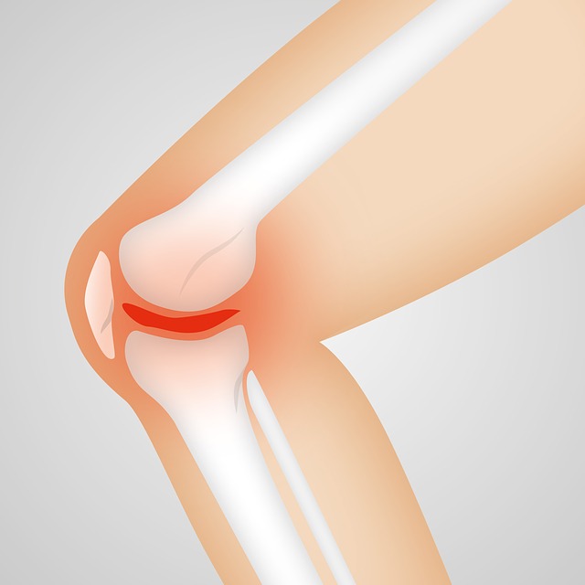 OSTEOARTHRITIS OF THE KNEE – DIETS