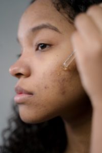 Argan Oil for Acne Treatment: Good or Bad?